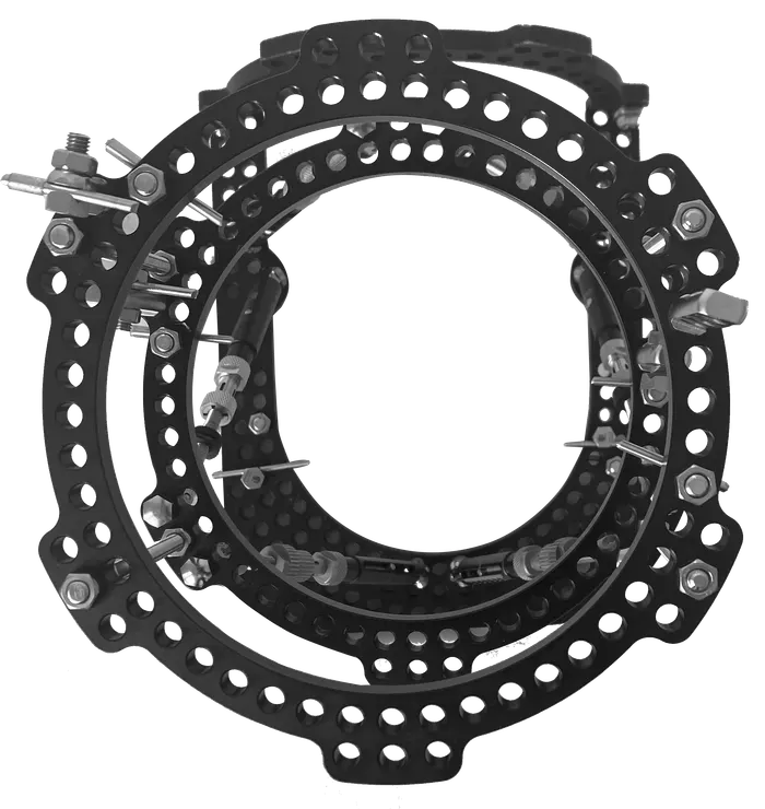 FrameIT external fixation frame — ring assembly with connection hardware
