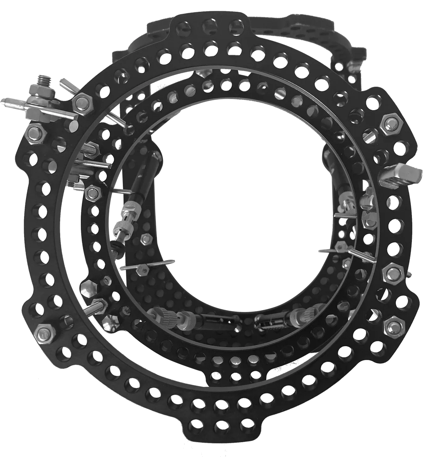 FrameIT external fixation frame — ring assembly with connection hardware